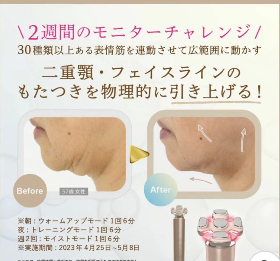 T*7様 美顔器クリニック級幹細胞湘南美容外科全面監督医療レベル美顔器ベビースキ