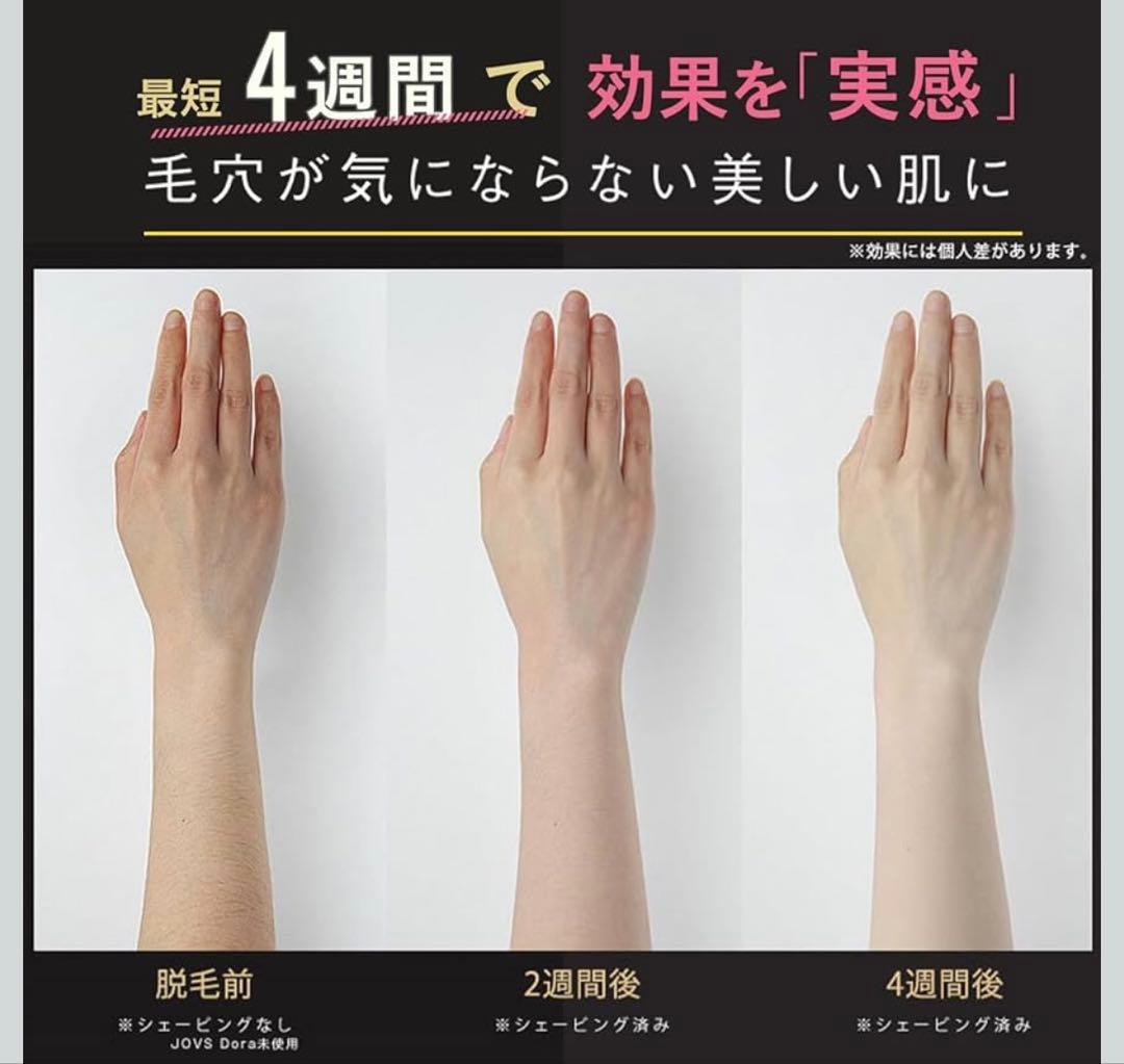 JOVS 脱毛器 エメラルド【最終値下げ】